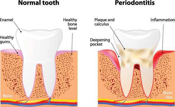 Lake Harris Dental | Oral Exams, Juvederm reg  and Dental Fillings